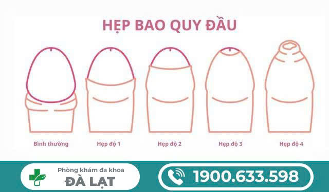 Hình ảnh minh họa